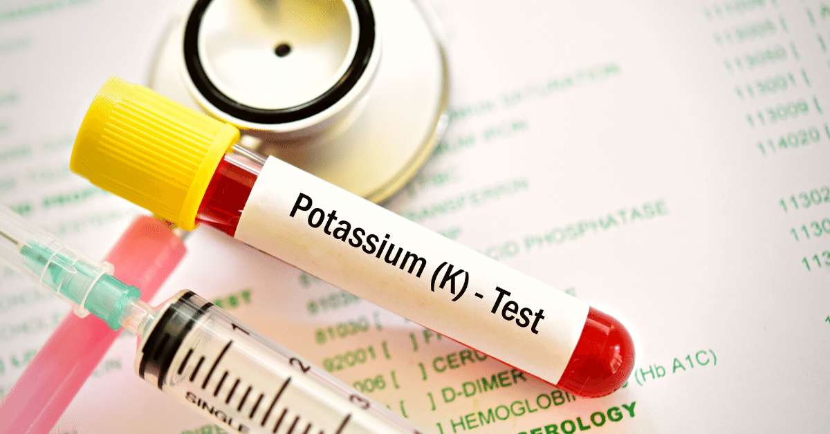 potassium test